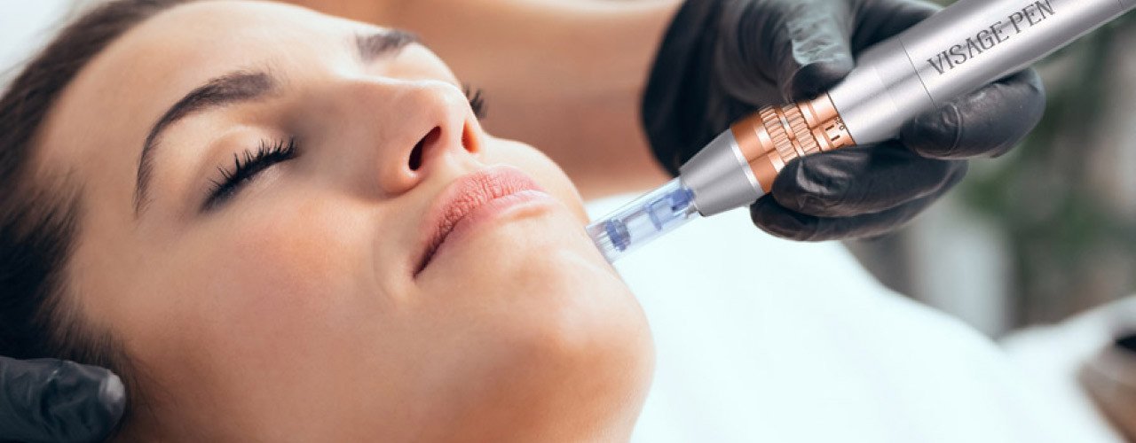 Das Verfahren der Microneedling Behandlung