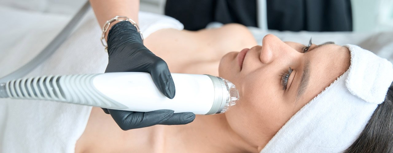 Microneedling Radiofrequenz bei Visage Cosmetic
