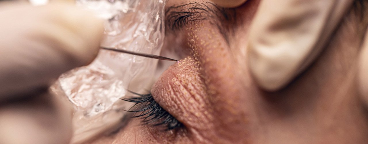 Visage Plasma Skin Behandlung: Ablauf und Pflege