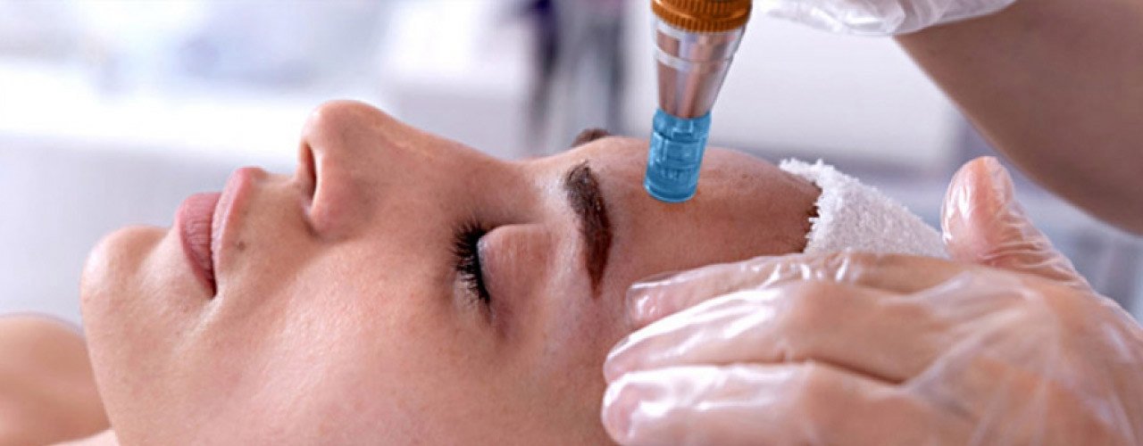 Microneedling Schulung