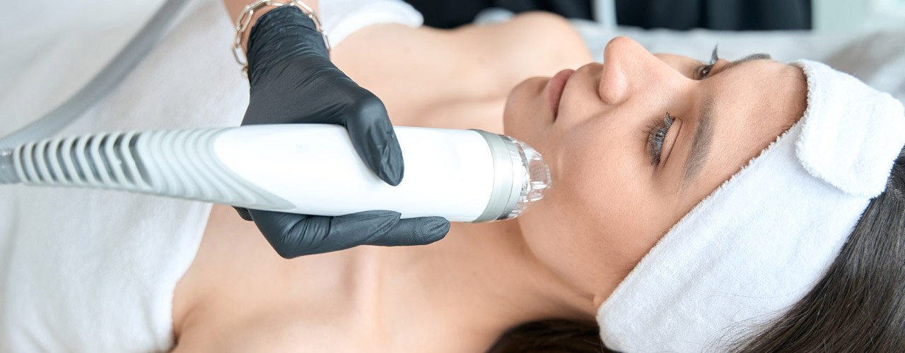 Microneedling RF Behandlung