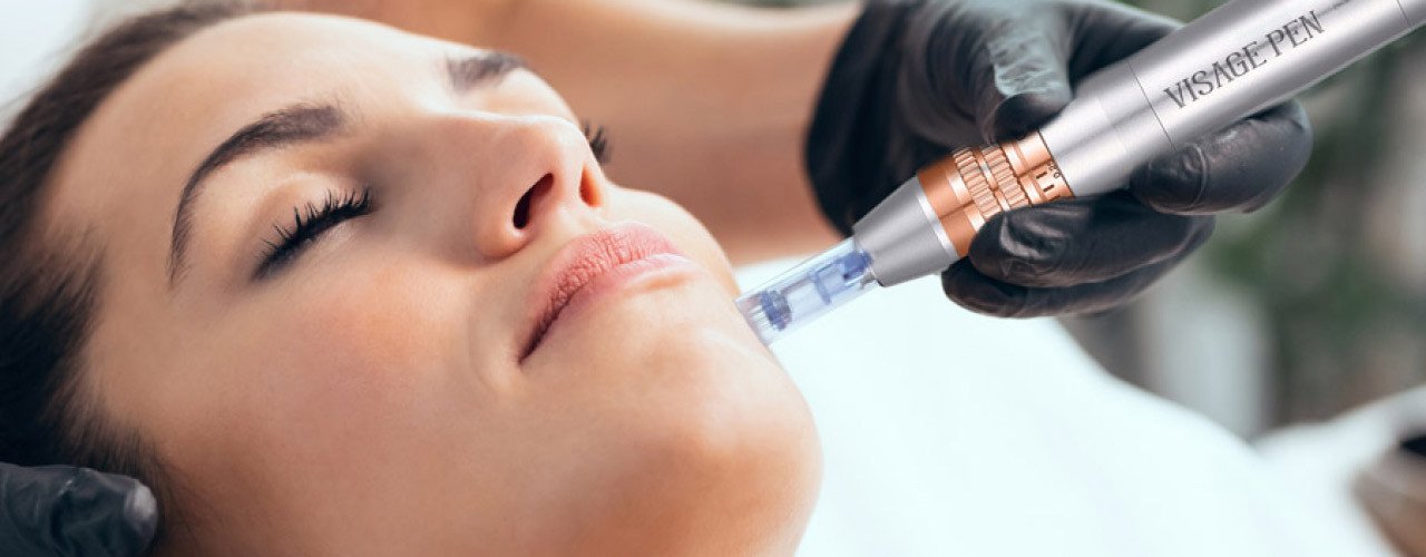 Microneedling